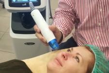 DeAge micro needle fractional radiofrequency